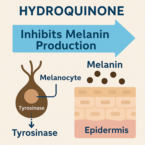 Visual diagram showing how Hydroquinone inhibits melanin production