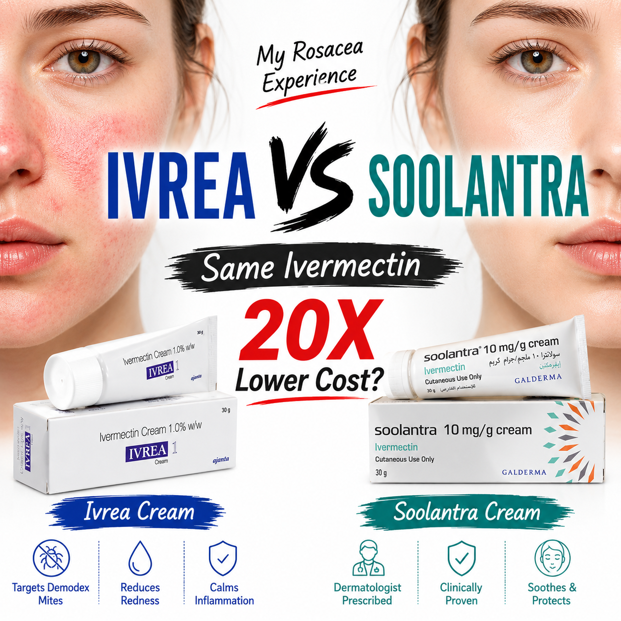 Ivrea Cream vs Soolantra: My Honest Experience Using Ivermectin Cream for Rosacea